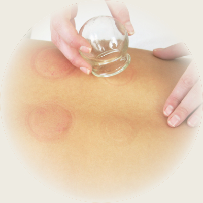 cupping