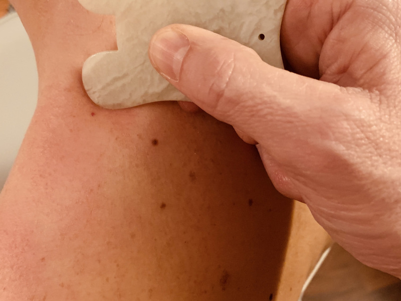 gua-sha